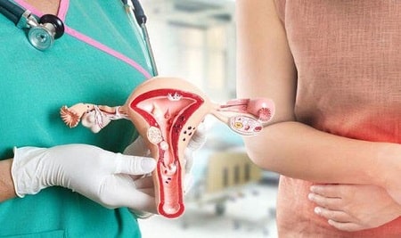 Chụp tử cung vòi trứng có làm rối loạn kinh nguyệt hay không?