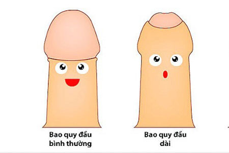 Bệnh về cậu nhỏ - Dài bao quy đầu
