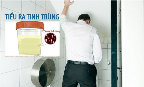 Đái ra tinh trùng