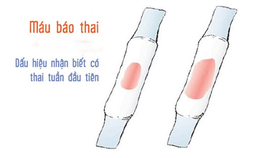 Dấu hiệu nhận biết máu báo thai