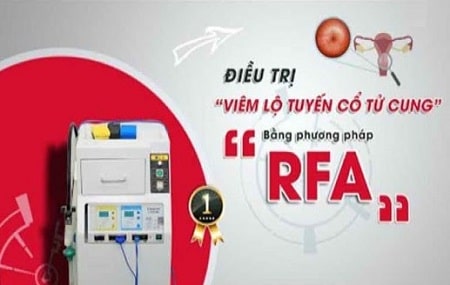Phương pháp điều trị viêm lộ tuyến hiệu quả, an toàn