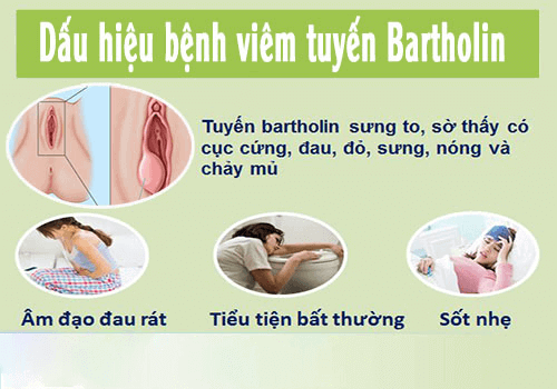 Dấu hiệu bị viêm tuyến bartholin