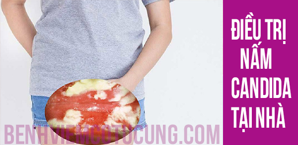 Có nên điều trị nấm candida tại nhà không ?