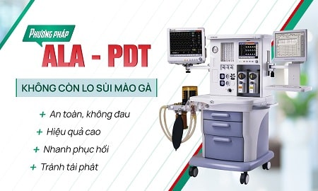 Phương pháp chữa sùi mào gà ALA - PDT là gì?