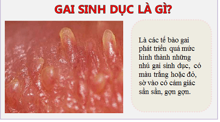 Giải đáp từ chuyên gia: Gai sinh dục nữ xuất hiện khi nào ?
