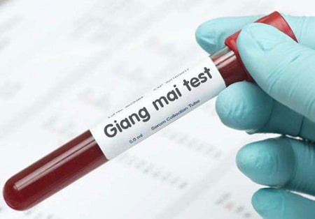 Giá xét nghiệm giang mai là bao nhiêu ?