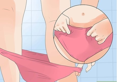 Hình ảnh viêm nhiễm phụ khoa ở nữ giới