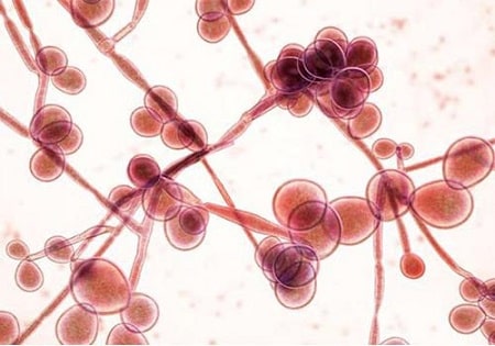 Vì sao xuất hiện hình ảnh nấm Candida ?