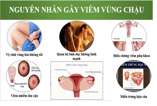 Nguyên nhân viêm vùng chậu
