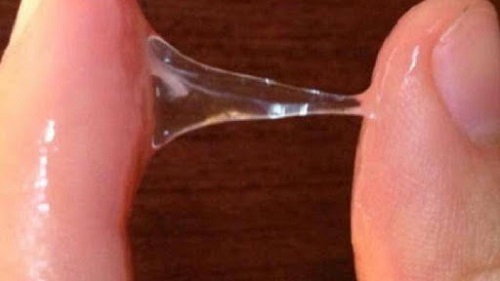 Khí hư bình thường