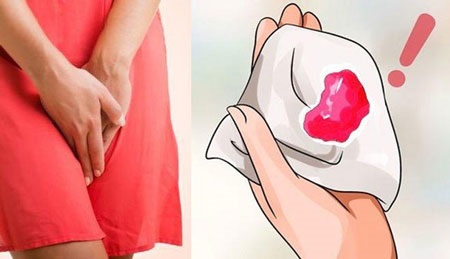 Một số dấu hiệu sắp có kinh nguyệt thường gặp