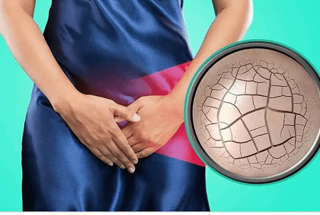 Khô âm đạo là gì, có biểu hiện ra sao ?