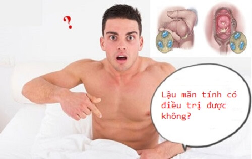 Lậu mãn tính có thể chữa khỏi được nếu tuân thủ theo phác đồ của bác sĩ chuyên khoa