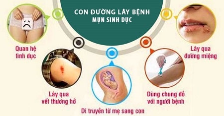 Mụn rộp sinh dục ở vùng kín lây truyền qua con đường nào ?