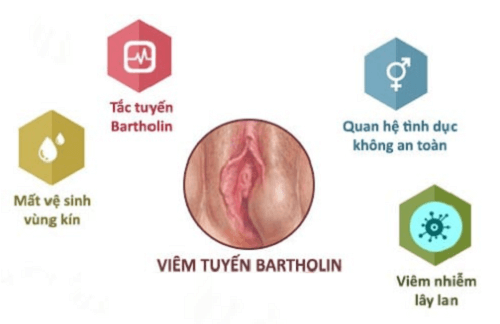 Viêm tuyến bartholin có ảnh hưởng gì không