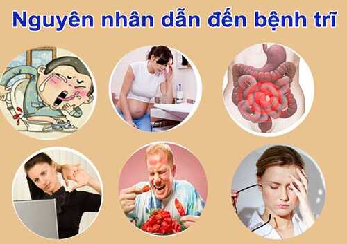 Nguyên nhân gây bệnh trĩ nội
