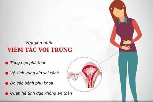Nguyên nhân gây viêm tắc vòi trứng