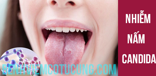 Nhiễm nấm Candida là gì?