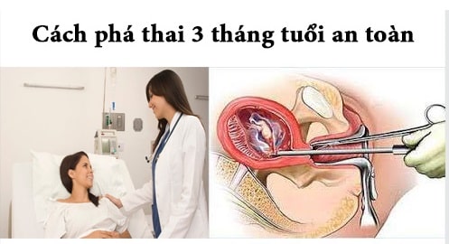 Thai 3 tháng tuổi có phá được không ?