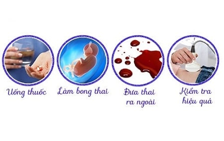 Tìm hiểu phá thai bằng thuốc thành công là gì?