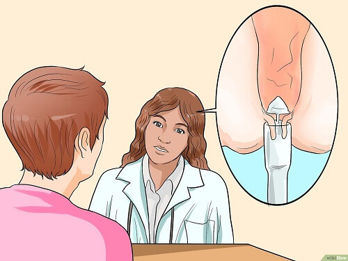 Phẫu thuật cắt da thừa hậu môn sau bao lâu khỏi tùy thuộc vào nhiều yếu tố