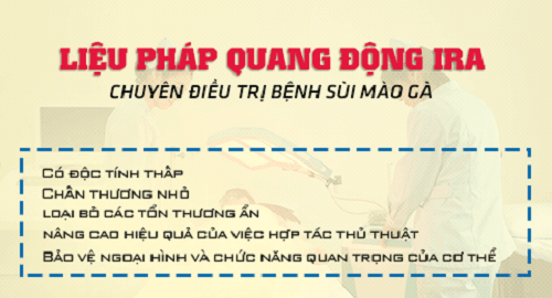 Liệu pháp quang động IRA điều trị sùi mào gà hiệu quả