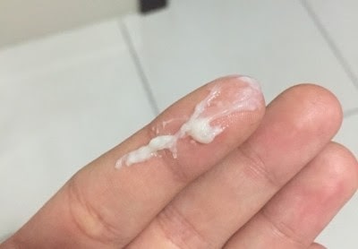  Ra khí hư màu trắng sữa có nguy hiểm không? 