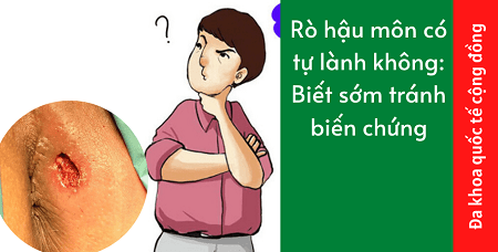 Giải đáp: Rò hậu môn có hết không?