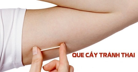 Que tránh thai có hiệu quả như thế nào ?