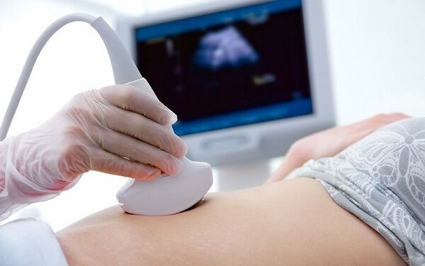 Siêu âm chuẩn đoán buồng trứng đa nang nhanh