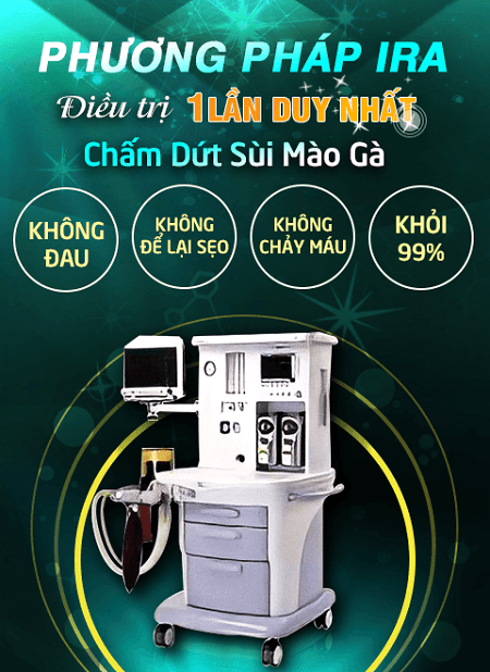 Chữa sùi mào gà bằng đốt điện cao tần IRA :