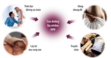 Sùi mào gà có lây không?