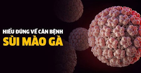 Sùi mào gà là bệnh gì ?