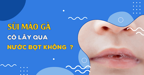 Sùi mào gà lây qua đường nước bọt