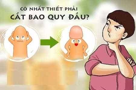 Khi nào nên cắt bao quy đầu
