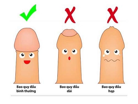Bao quy đầu là gì ?