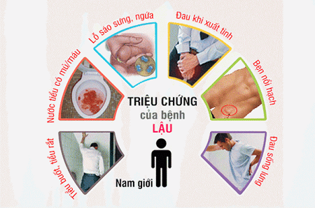 Các triệu chứng của bệnh lậu cụ thể theo đặc điểm giới
