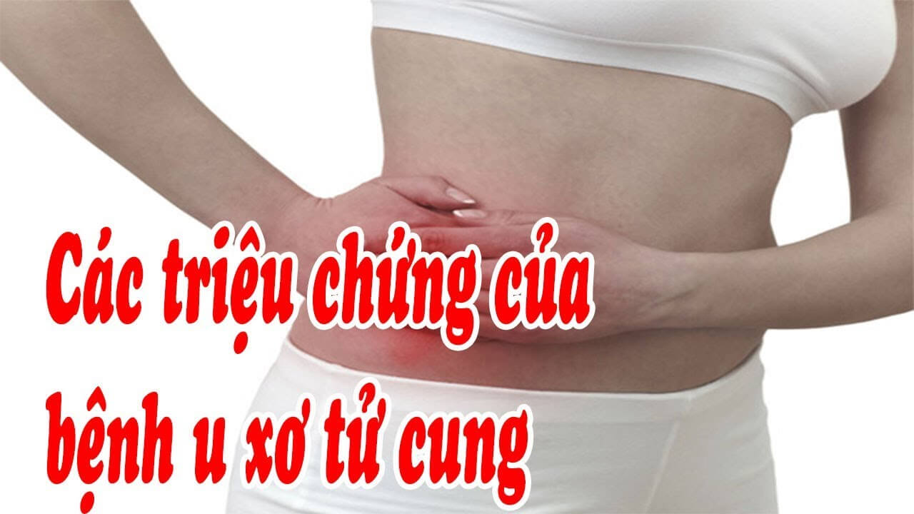 Triệu chứng nhận biết bệnh u xơ không thể bỏ qua