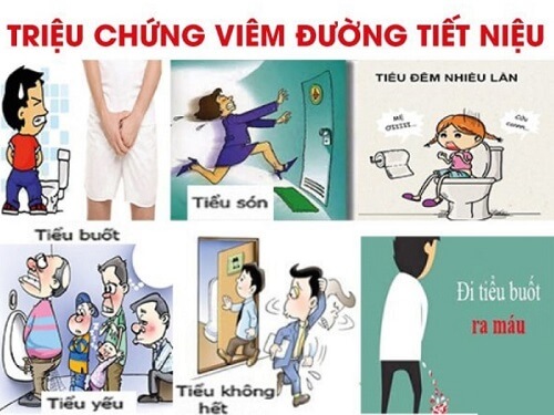 Triệu chứng viêm đường tiết niệu nam và nữ giới
