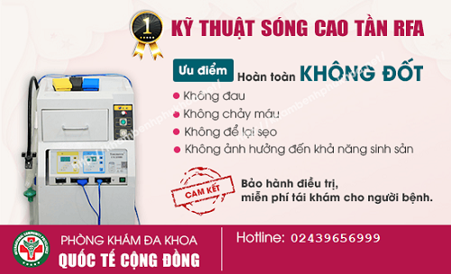 Ưu điểm khi điều trị viêm lộ tuyến bằng phương pháp RFA