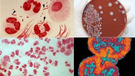 Đặc điểm của vi khuẩn gây bệnh lậu là gì ? 