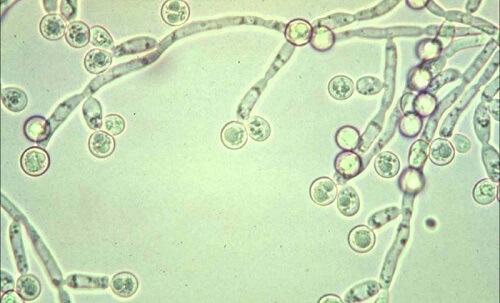 Vi nấm Candida