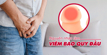Nguyên nhân gây viêm bao quy đầu mãn tính