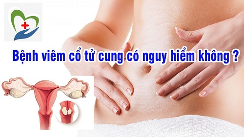 Viêm cổ tử cung có nguy hiểm không?