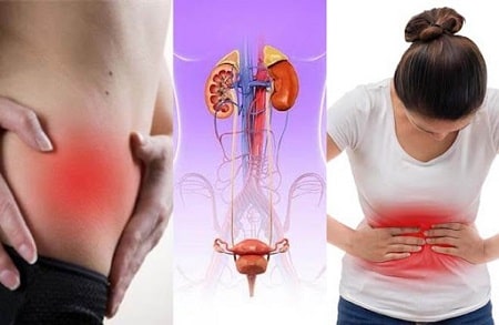 Viêm niệu đạo mãi không khỏi có ảnh hưởng gì?