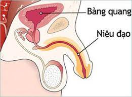  Đau dương vật do viêm niệu đạo