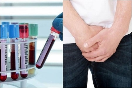 Xét nghiệm bệnh lậu hết bao nhiêu tiền?