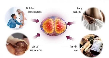 Bệnh lậu và các con đường lây nhiễm bệnh lậu