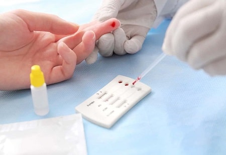 Xét nghiệm giang mai sau bao lâu thì chính xác nhất? 