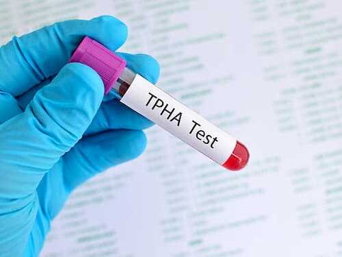 Xét nghiệm TPHA chuẩn đoán giang mai